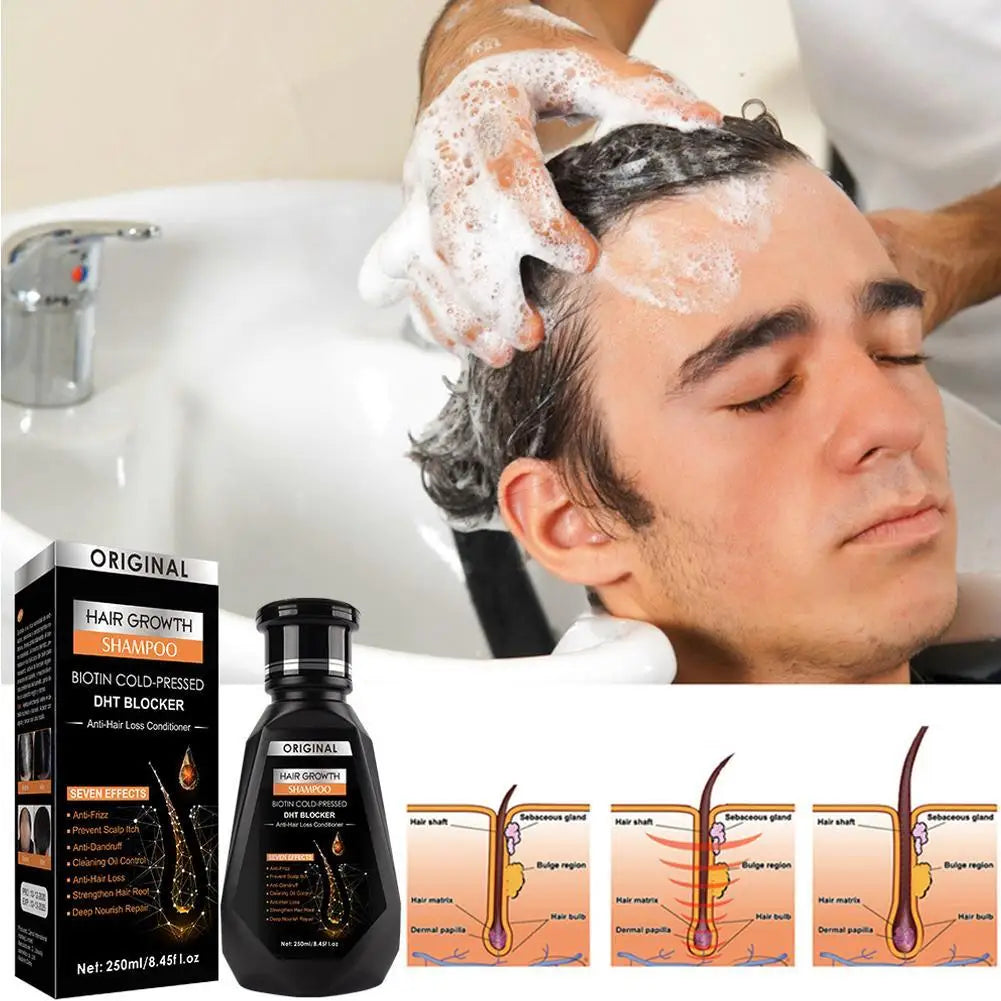 Hair Growth Shampoo, Ginger Shampoo Deep Cleaning Nourish Scalp Deep Cleaning Nourish Scalp Enhance Hair Elasticity Hair Tools Eagle Beacon