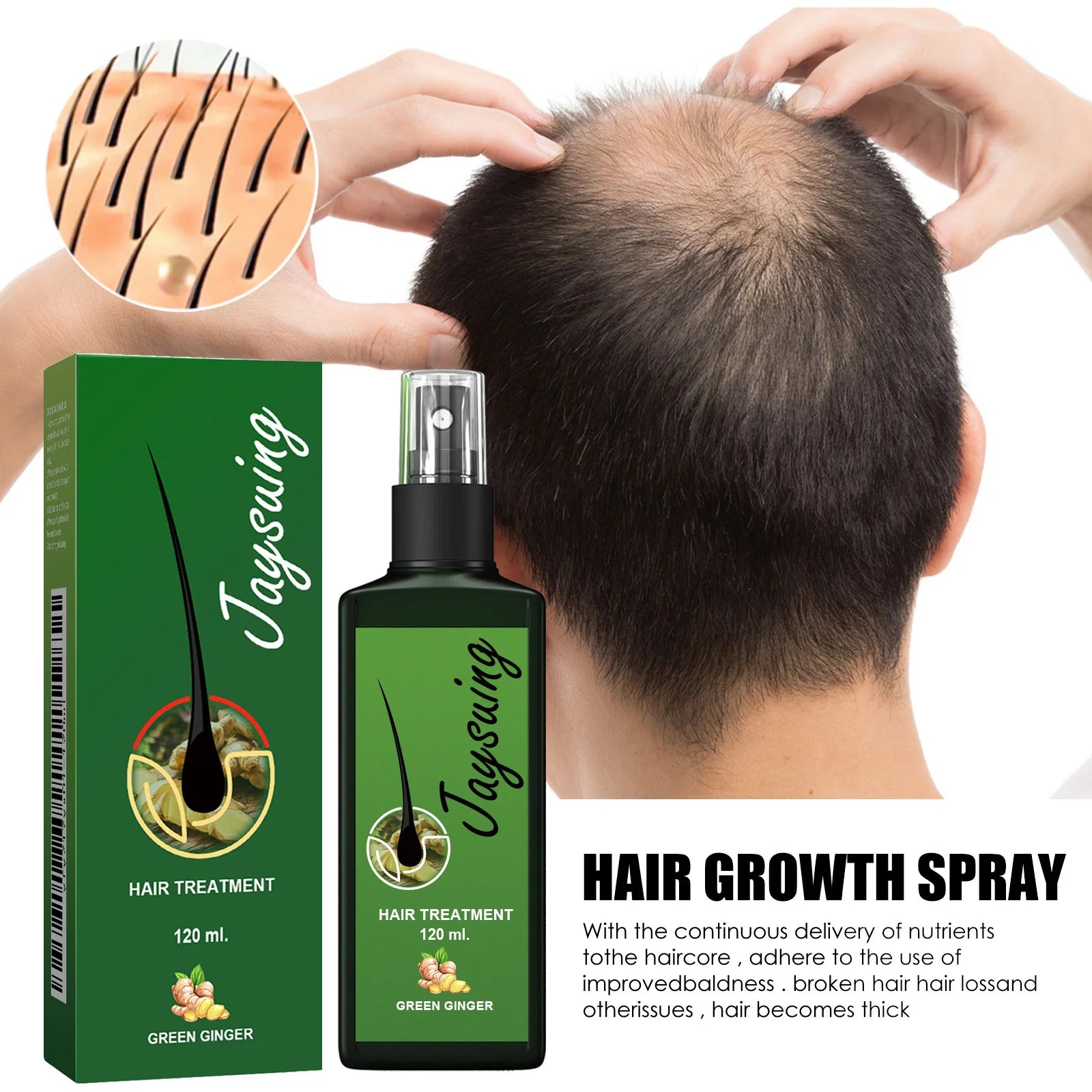 Hair Growth Spray Ginger Massage Scalp Damaged Treatment Solution Nourish Roots Fast Grow Anti Hair Loss Serum Beauty Health Eagle Beacon