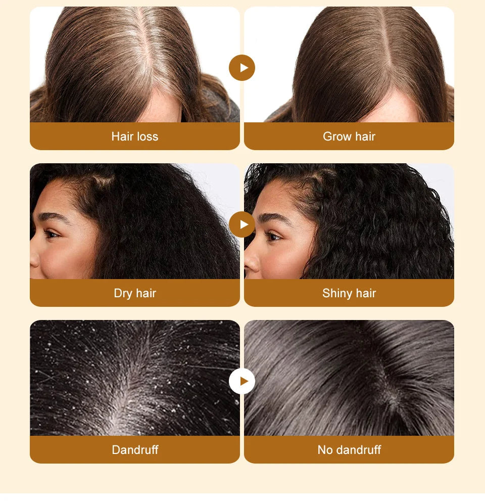 Hair Growth Batana Oil Serum Fast Growing Hair Essential Oil Beauty Hair Care Anti-Hair Loss Essence Natural Repair Damaged Hair Eagle Beacon