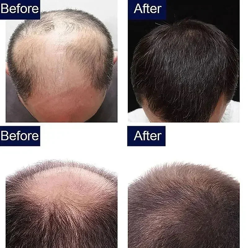 7 Day Fast Hair Growth Oil Ginger Growth Hair Treatment Anti Hair Loss Men Women Scalp Treatment Serum Products Beauty Product Eagle Beacon