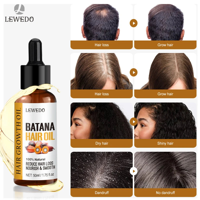 Hair Growth Batana Oil Serum Fast Growing Hair Essential Oil Beauty Hair Care Anti-Hair Loss Essence Natural Repair Damaged Hair Eagle Beacon
