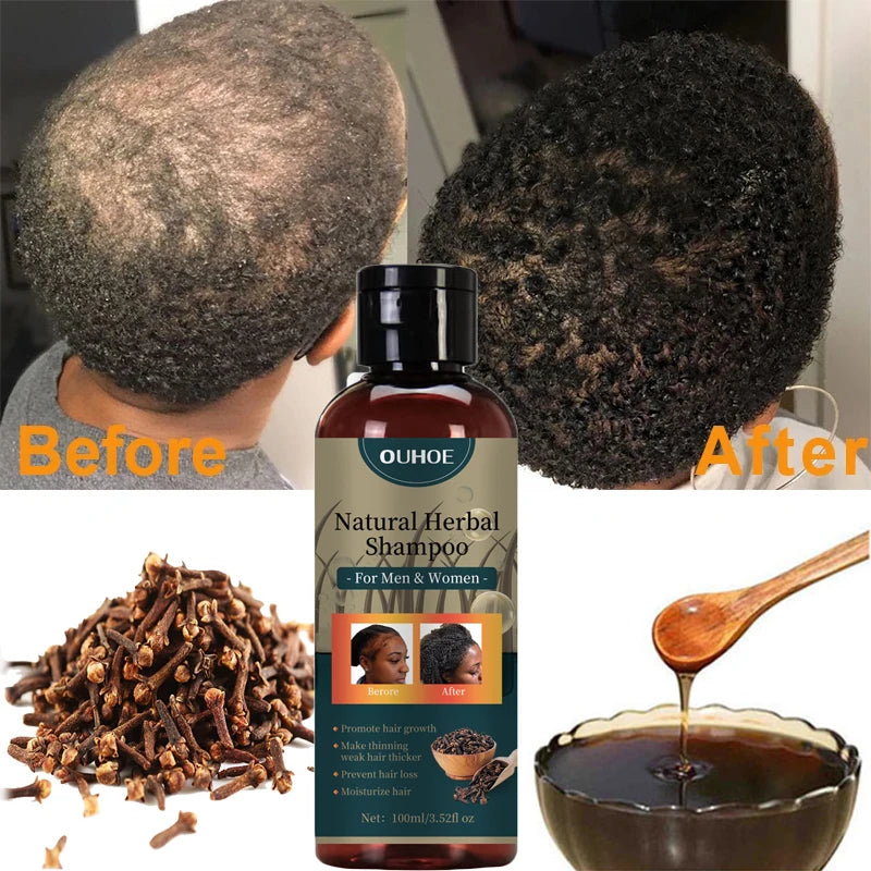 Hair Growth Shampoo Ancient African Hair Growth Formula Extract Powerful Effect Fast Hair Loss Treatment Hair Care 100ml Eagle Beacon