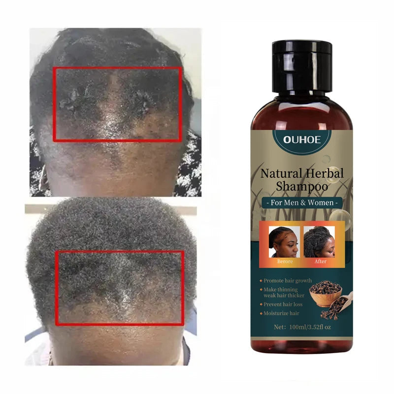 Hair Growth Shampoo Ancient African Hair Growth Formula Extract Powerful Effect Fast Hair Loss Treatment Hair Care 100ml Eagle Beacon