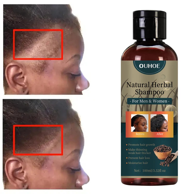 Hair Growth Shampoo Ancient African Hair Growth Formula Extract Powerful Effect Fast Hair Loss Treatment Hair Care 100ml Eagle Beacon