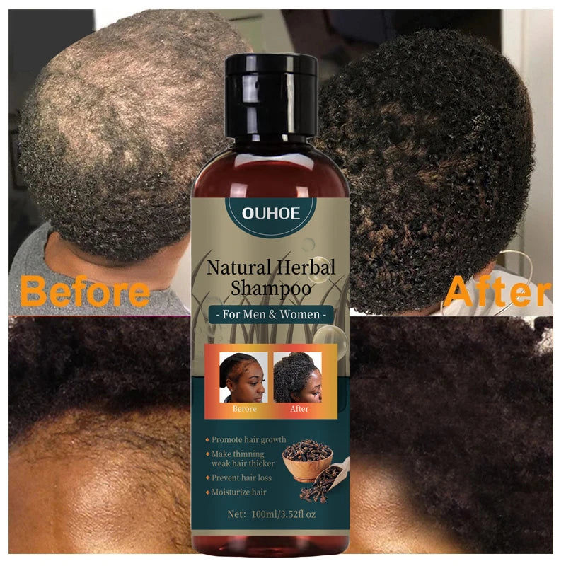 Hair Growth Shampoo Ancient African Hair Growth Formula Extract Powerful Effect Fast Hair Loss Treatment Hair Care 100ml Eagle Beacon