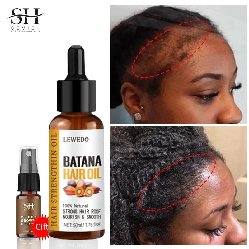 Hair Growth Batana Oil Serum Fast Growing Hair Essential Oil Beauty Hair Care Anti-Hair Loss Essence Natural Repair Damaged Hair Eagle Beacon
