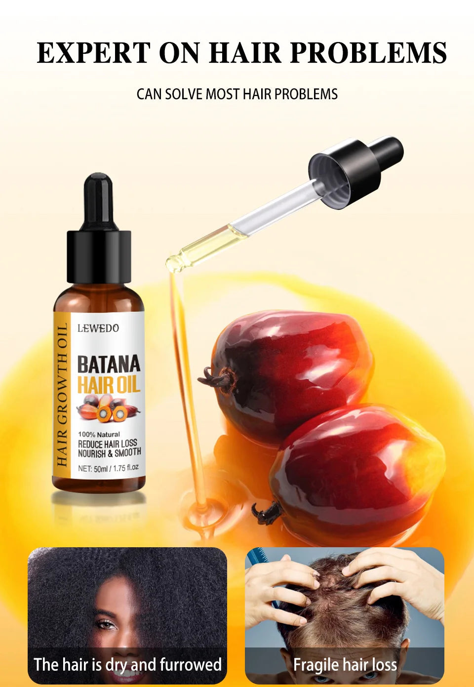 Hair Growth Batana Oil Serum Fast Growing Hair Essential Oil Beauty Hair Care Anti-Hair Loss Essence Natural Repair Damaged Hair Eagle Beacon