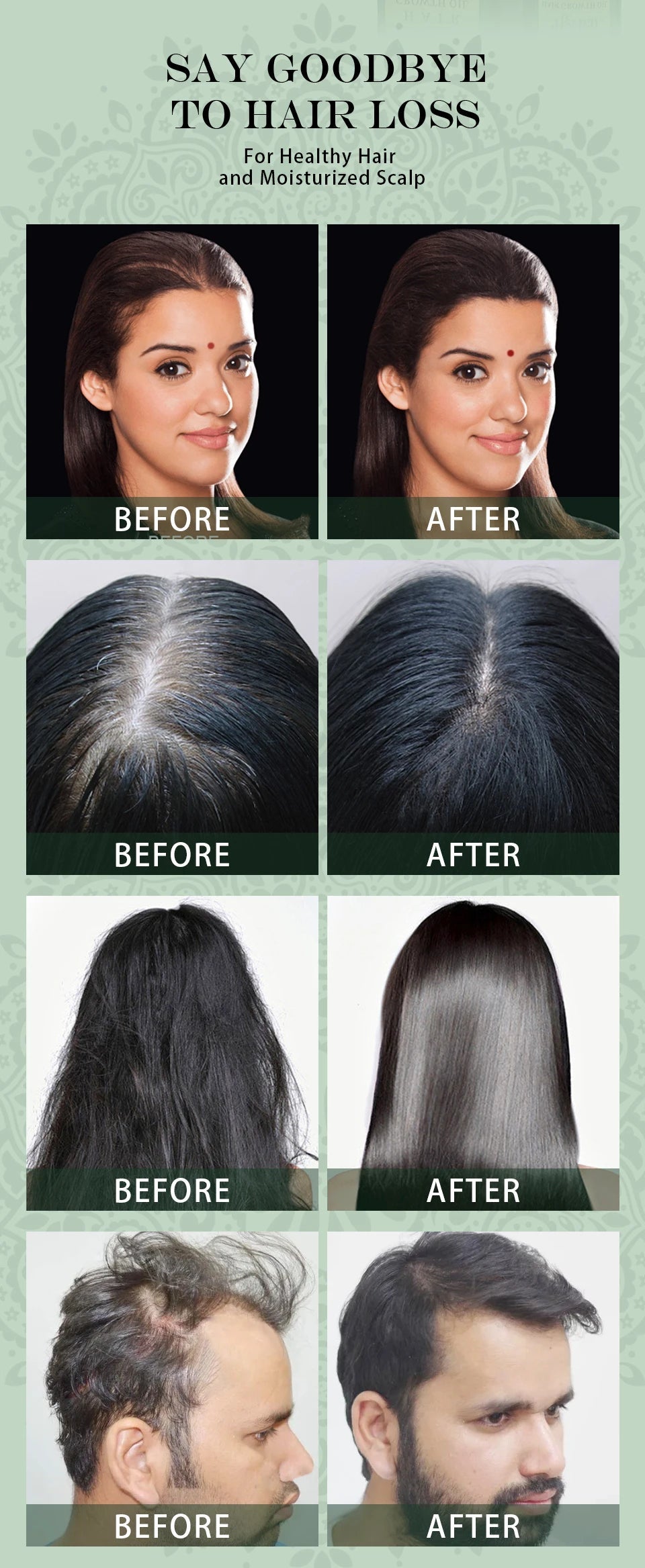 Ayurvedic Hair Growth Oil India Adivasi Organic Hair Growth Serum Anti Hair Loss Fast Regrowth Thicken Oils Hair Growth Products Eagle Beacon