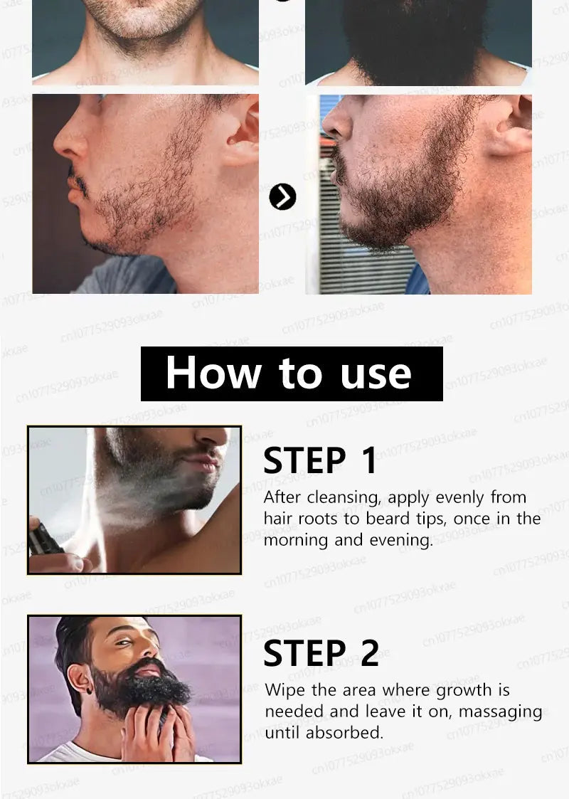 The most effective beard growth essence in 2025, grow a thick beard in 7 days. Chest hair, leg hair, beard and hair growth Eagle Beacon