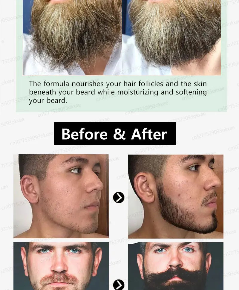 The most effective beard growth essence in 2025, grow a thick beard in 7 days. Chest hair, leg hair, beard and hair growth Eagle Beacon