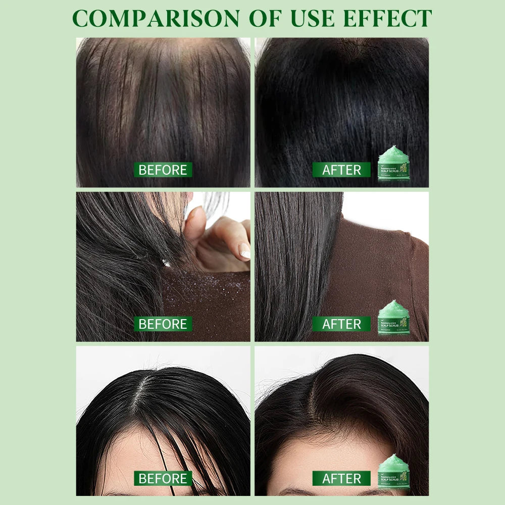 Hair Growth Spray,Scalp Scrub,Rosemary Scalp Exfoliator Scrub Shampoo,Hair Booster Serum,Strengthens Hair Roots,Helps Strengthen Eagle Beacon