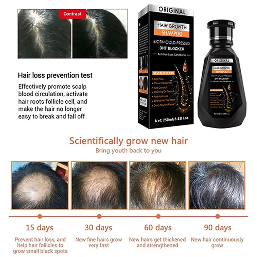 Hair Growth Shampoo, Ginger Shampoo Deep Cleaning Nourish Scalp Deep Cleaning Nourish Scalp Enhance Hair Elasticity Hair Tools Eagle Beacon