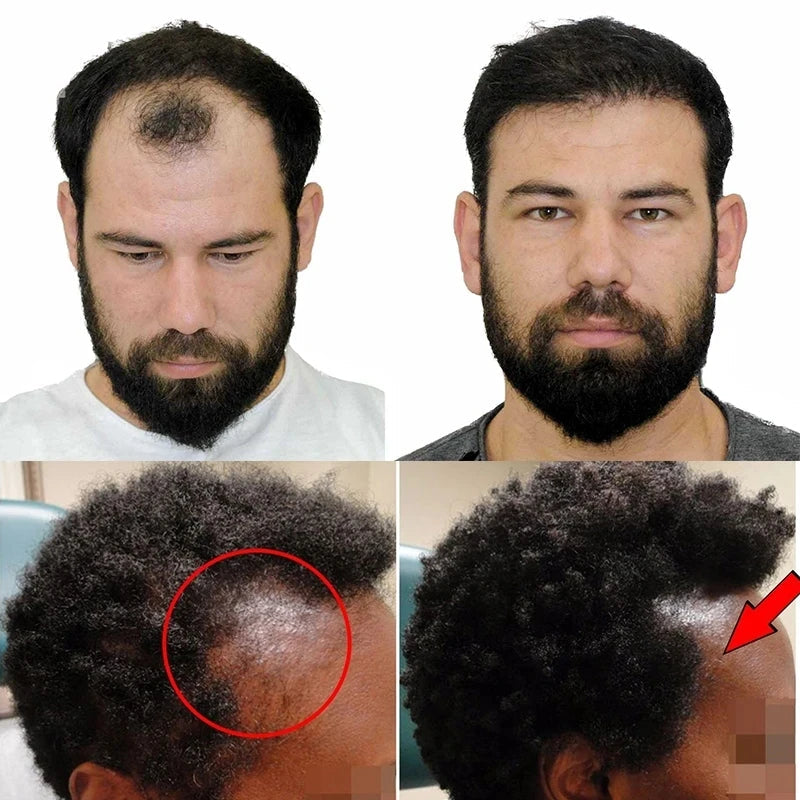 Hair Growth Shampoo Ancient African Hair Growth Formula Extract Powerful Effect Fast Hair Loss Treatment Hair Care 100ml Eagle Beacon