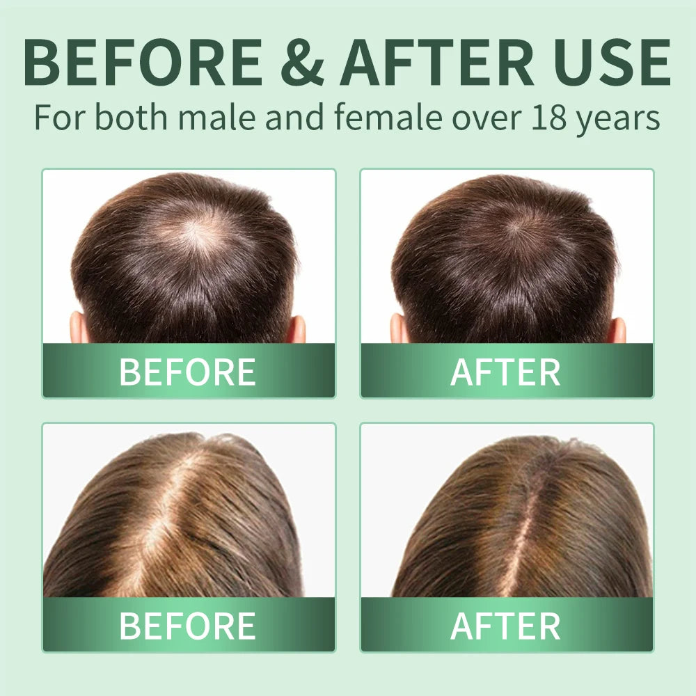 Hair Growth Spray,Scalp Scrub,Rosemary Scalp Exfoliator Scrub Shampoo,Hair Booster Serum,Strengthens Hair Roots,Helps Strengthen Eagle Beacon