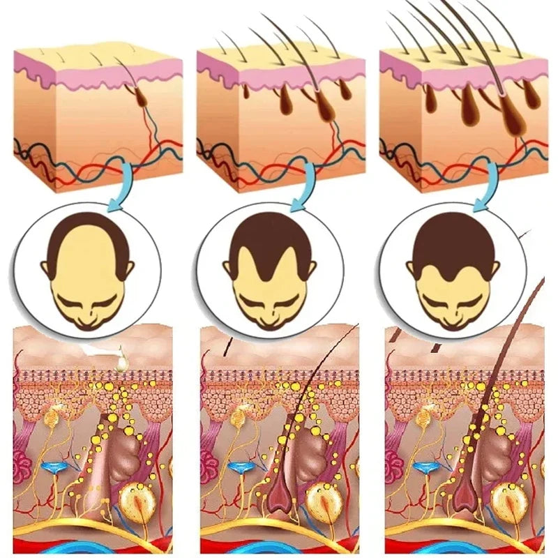 7 Days Ginger Hair Growth Serum Fast Promote Hair Regrowth Products Anti Hair Loss Repair Scalp Baldness Nourish Hair Root Care Eagle Beacon