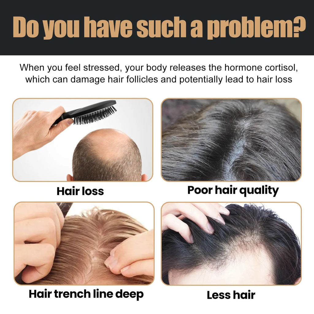 Hair Loss Treatment Shampoo Promote Growth Strengthen Hair Roots Scalp Repair Anti Thinning Moisturizing Thickening Hair Care Eagle Beacon
