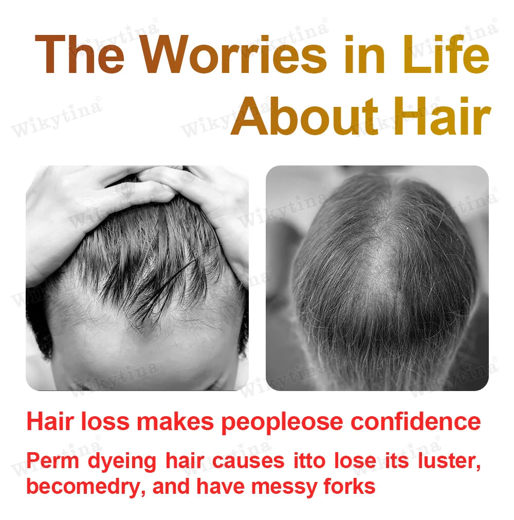 Clinical Grade LLLT Hair Regrowth Device Anti Hair Loss Machine For Scalp Health Thinning Hair Stress Anxiety Management Eagle Beacon