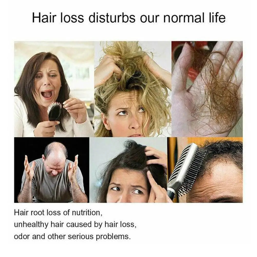 Hair Growth Shampoo, Ginger Shampoo Deep Cleaning Nourish Scalp Deep Cleaning Nourish Scalp Enhance Hair Elasticity Hair Tools Eagle Beacon