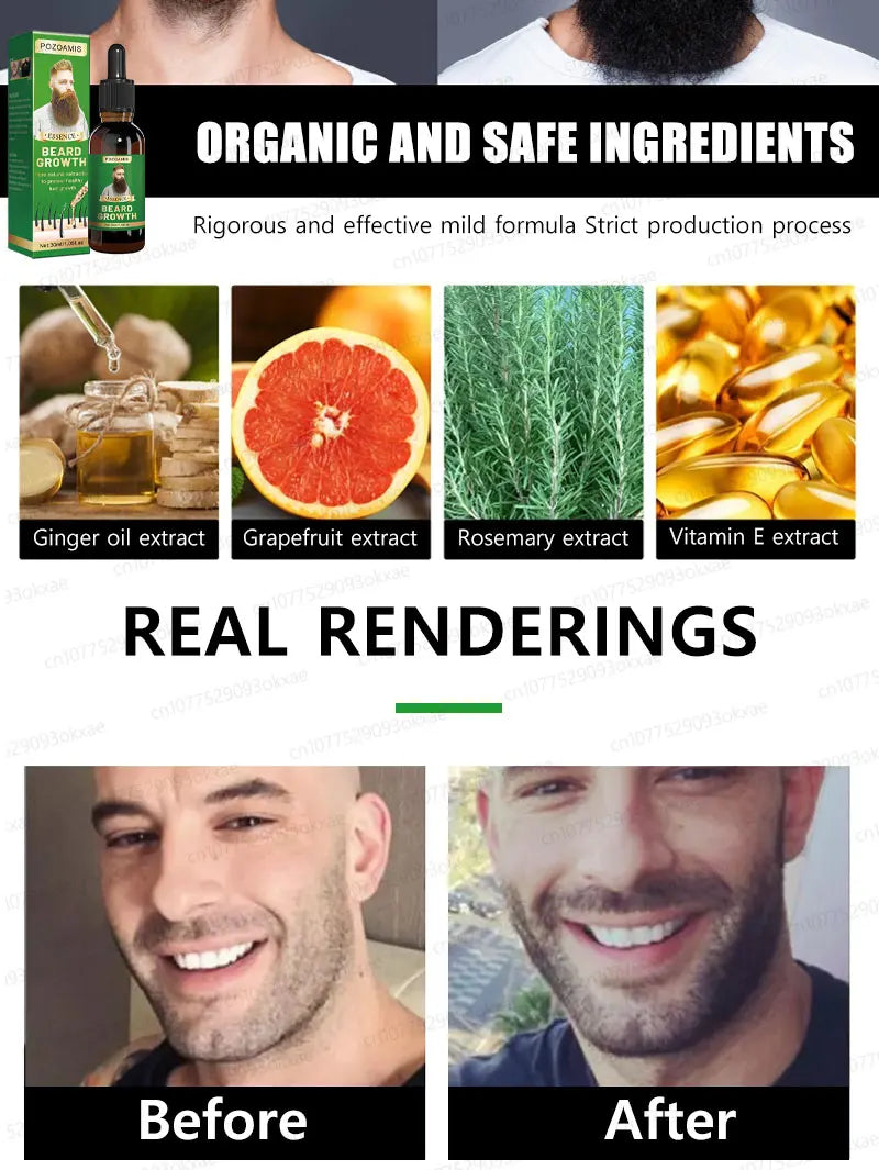 The most effective beard growth essence in 2025, grow a thick beard in 7 days. Chest hair, leg hair, beard and hair growth Eagle Beacon