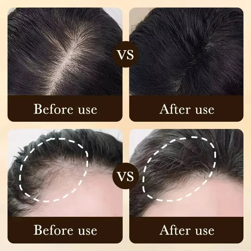 Hair Growth Treatment Strengthens Hair Nourishes Scalp Light Weight Non Greasy Improve Scalp Circulation Eagle Beacon