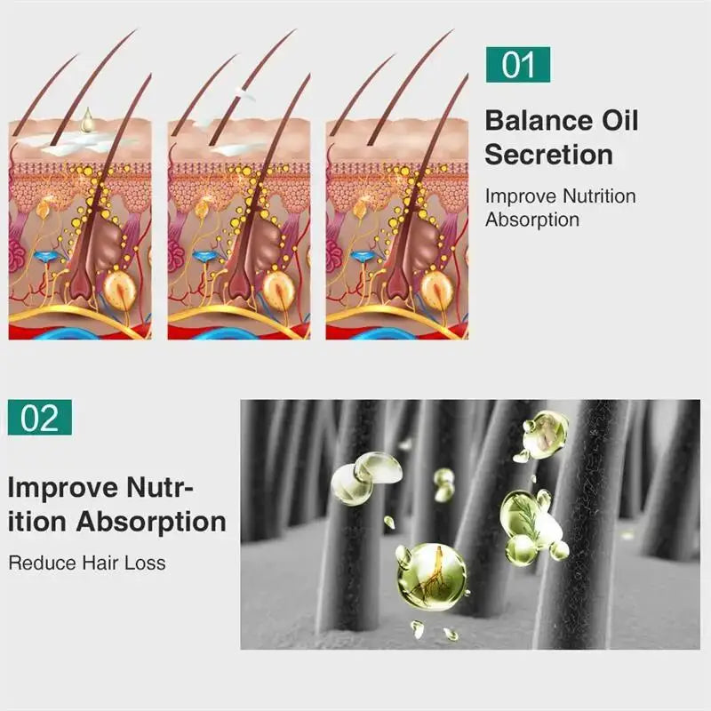 7 Days Ginger Hair Growth Serum Fast Promote Hair Regrowth Products Anti Hair Loss Repair Scalp Baldness Nourish Hair Root Care Eagle Beacon