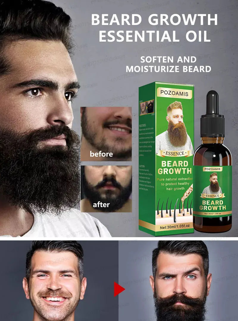 The most effective beard growth essence in 2025, grow a thick beard in 7 days. Chest hair, leg hair, beard and hair growth Eagle Beacon