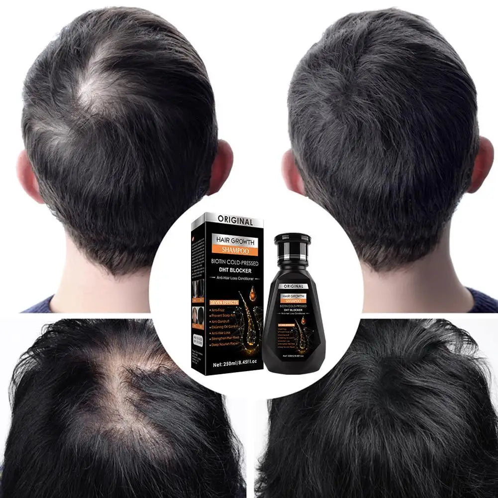 Hair Growth Shampoo, Ginger Shampoo Deep Cleaning Nourish Scalp Deep Cleaning Nourish Scalp Enhance Hair Elasticity Hair Tools Eagle Beacon