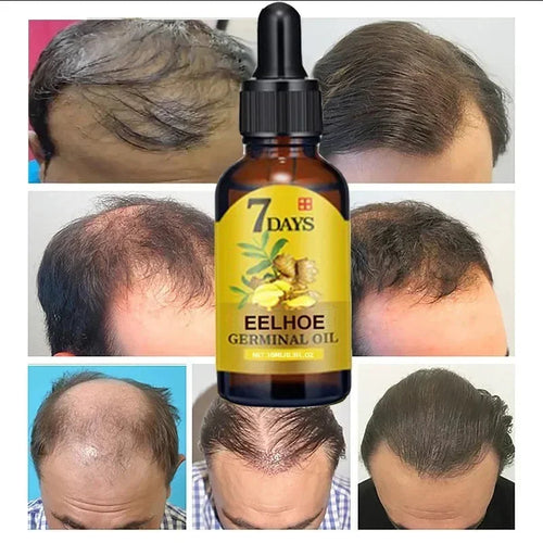 7 Day Fast Hair Growth Oil Ginger Growth Hair Treatment Anti Hair Loss Men Women Scalp Treatment Serum Products Beauty Product Eagle Beacon