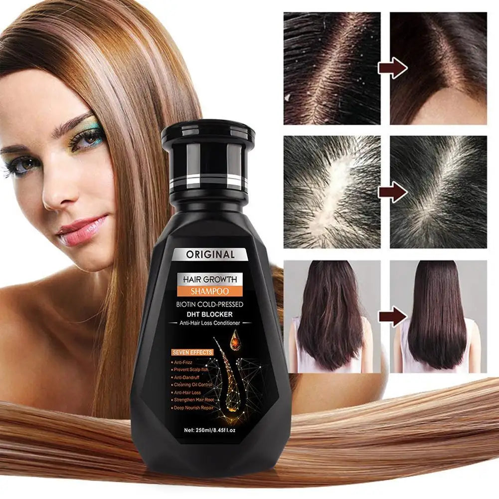Hair Growth Shampoo, Ginger Shampoo Deep Cleaning Nourish Scalp Deep Cleaning Nourish Scalp Enhance Hair Elasticity Hair Tools Eagle Beacon