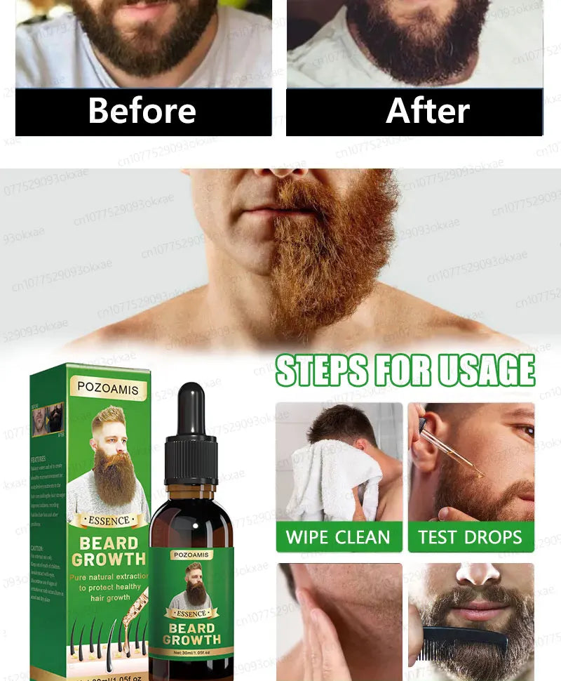 The most effective beard growth essence in 2025, grow a thick beard in 7 days. Chest hair, leg hair, beard and hair growth Eagle Beacon