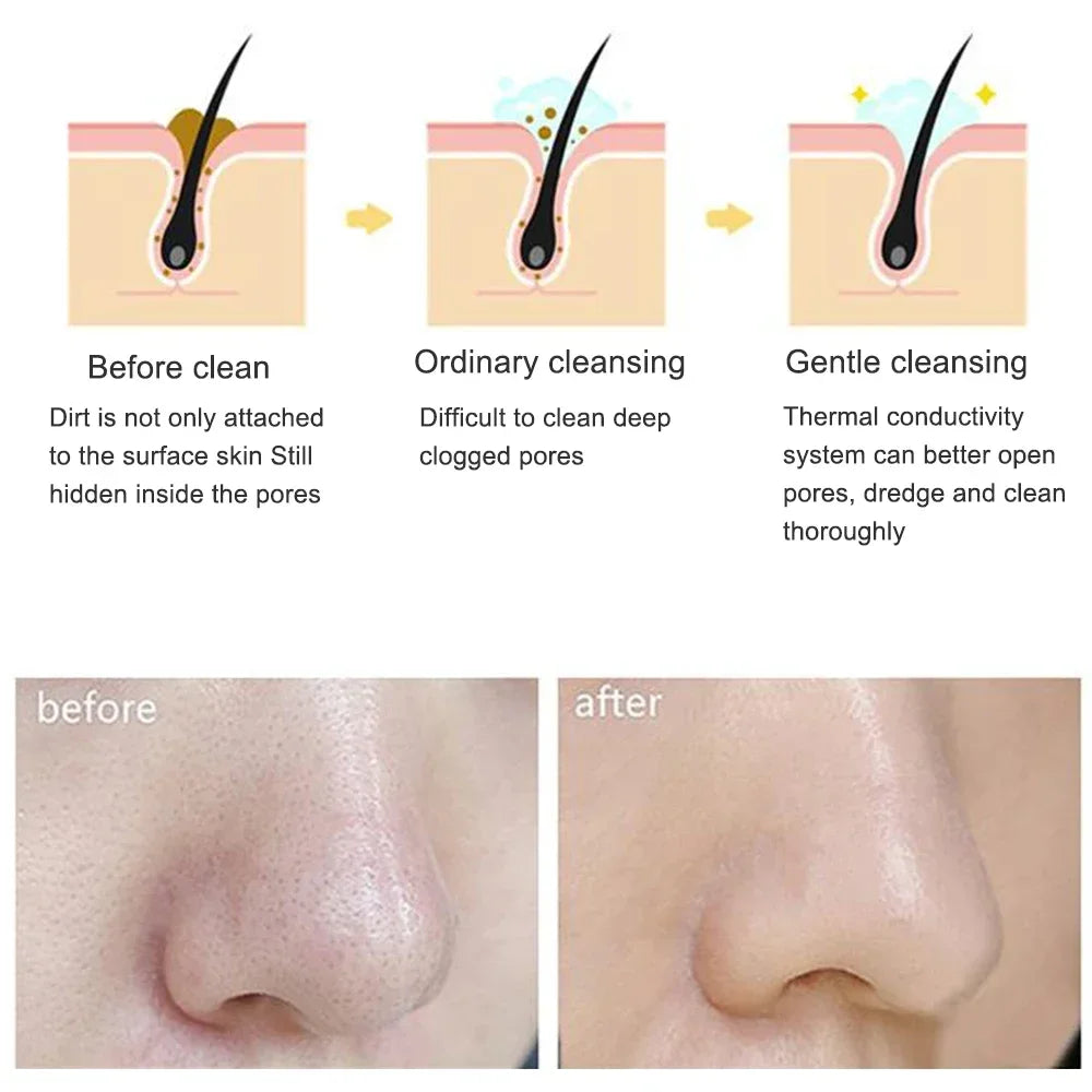 Electric Facial Cleansing Brush Face Skin Care Tools Waterproof Silicone Sonic Cleanser Facial Eagle Beacon