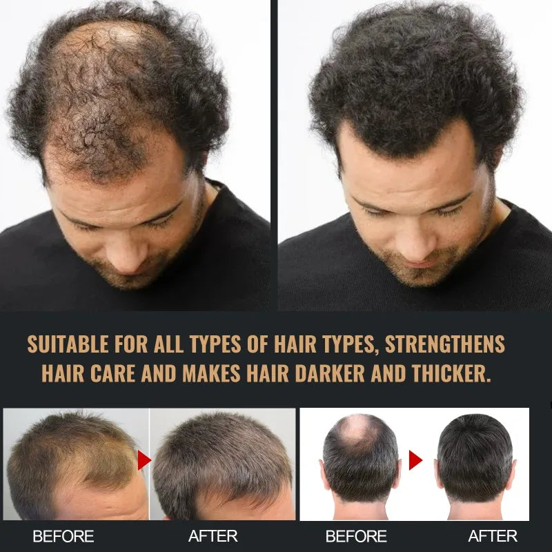Hair Loss Treatment Shampoo Promote Growth Strengthen Hair Roots Scalp Repair Anti Thinning Moisturizing Thickening Hair Care Eagle Beacon