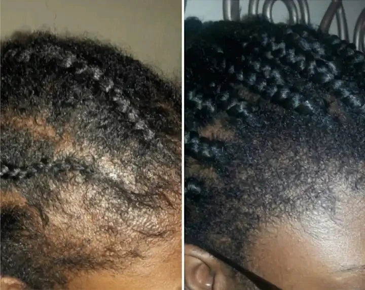 Hair Growth Shampoo Ancient African Hair Growth Formula Extract Powerful Effect Fast Hair Loss Treatment Hair Care 100ml Eagle Beacon