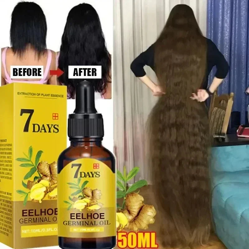 7 Day Fast Hair Growth Oil Ginger Growth Hair Treatment Anti Hair Loss Men Women Scalp Treatment Serum Products Beauty Product Eagle Beacon