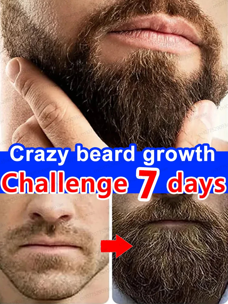 The most effective beard growth essence in 2025, grow a thick beard in 7 days. Chest hair, leg hair, beard and hair growth Eagle Beacon