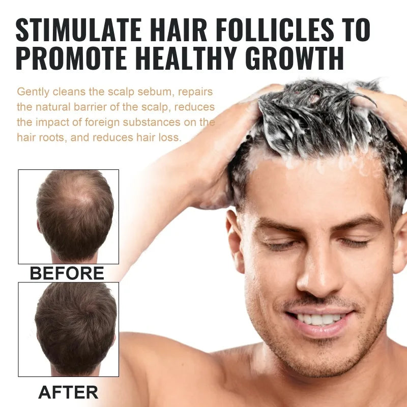 Hair Loss Treatment Shampoo Promote Growth Strengthen Hair Roots Scalp Repair Anti Thinning Moisturizing Thickening Hair Care Eagle Beacon